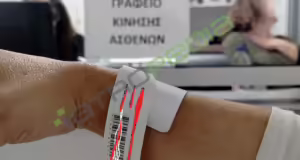 Άδωνις Γεωργιάδης: Οδηγίες για το «βραχιολάκι» στα Επείγοντα των νοσοκομείων – Τα 5 χρώματα και το τι σημαίνουν
